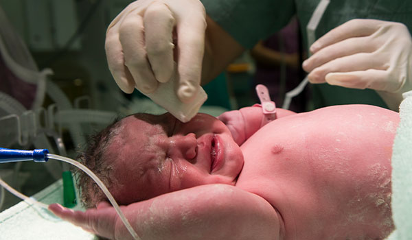 Neonatal Jaundice